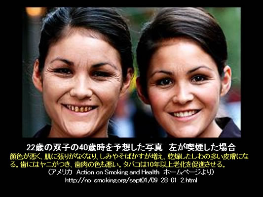 喫煙する人はすぐに老人となる？